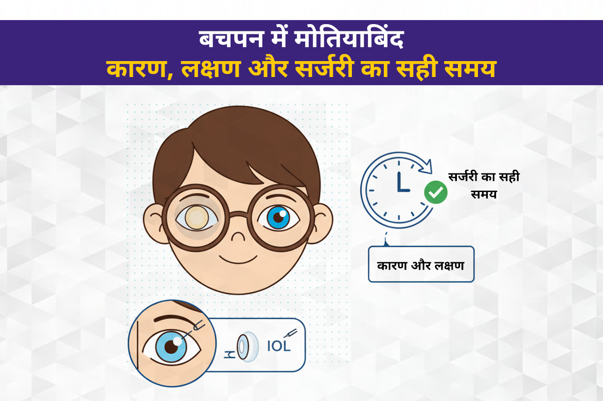 बचपन में मोतियाबिंद: कारण, लक्षण और सर्जरी का सही समय