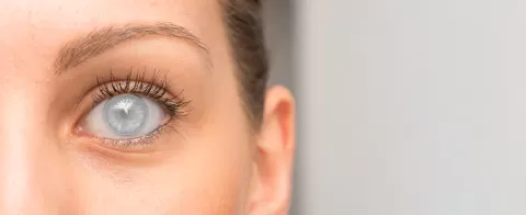 Cataract Surgery – How To Choose The Best Eye Care Center?