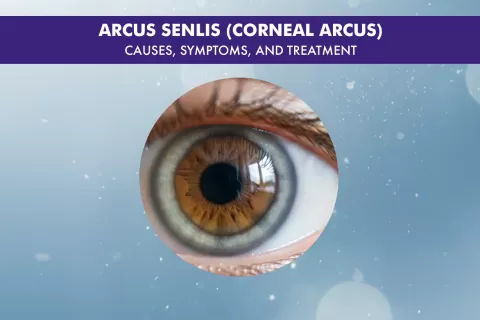 Cataract Surgery – How To Choose The Best Eye Care Center?