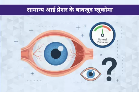 Cataract Surgery – How To Choose The Best Eye Care Center?