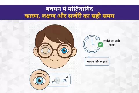 Cataract Surgery – How To Choose The Best Eye Care Center?