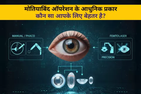 Cataract Surgery – How To Choose The Best Eye Care Center?