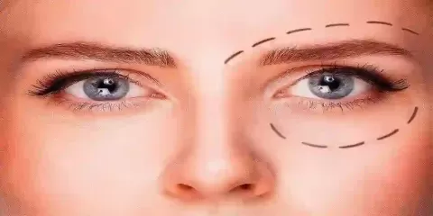 Cataract Surgery – How To Choose The Best Eye Care Center?