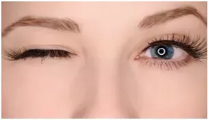 Cataract Surgery – How To Choose The Best Eye Care Center?
