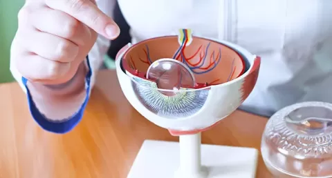 Cataract Surgery – How To Choose The Best Eye Care Center?