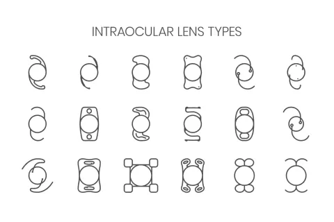 Cataract Surgery – How To Choose The Best Eye Care Center?