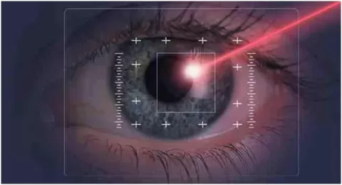 Cataract Surgery – How To Choose The Best Eye Care Center?