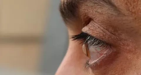 Cataract Surgery – How To Choose The Best Eye Care Center?