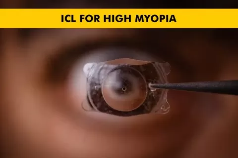 Cataract Surgery – How To Choose The Best Eye Care Center?