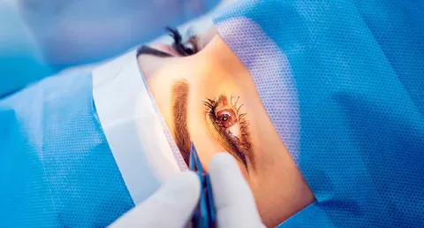 Cataract Surgery – How To Choose The Best Eye Care Center?