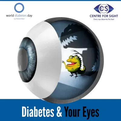 Cataract Surgery – How To Choose The Best Eye Care Center?