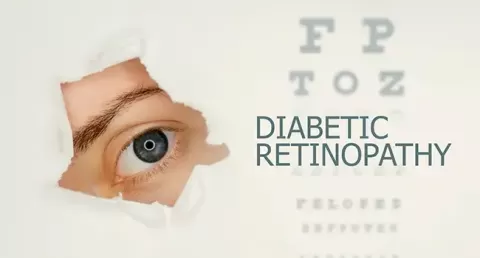 Cataract Surgery – How To Choose The Best Eye Care Center?