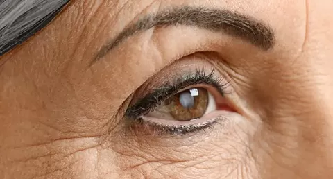 Cataract Surgery – How To Choose The Best Eye Care Center?
