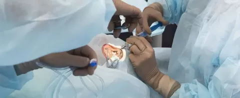 Cataract Surgery – How To Choose The Best Eye Care Center?