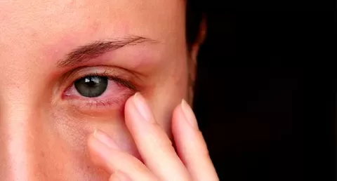 Cataract Surgery – How To Choose The Best Eye Care Center?
