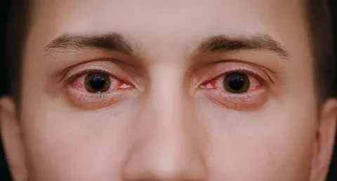 Cataract Surgery – How To Choose The Best Eye Care Center?