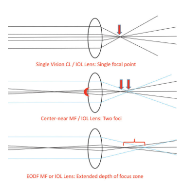 EDOF lens diagram