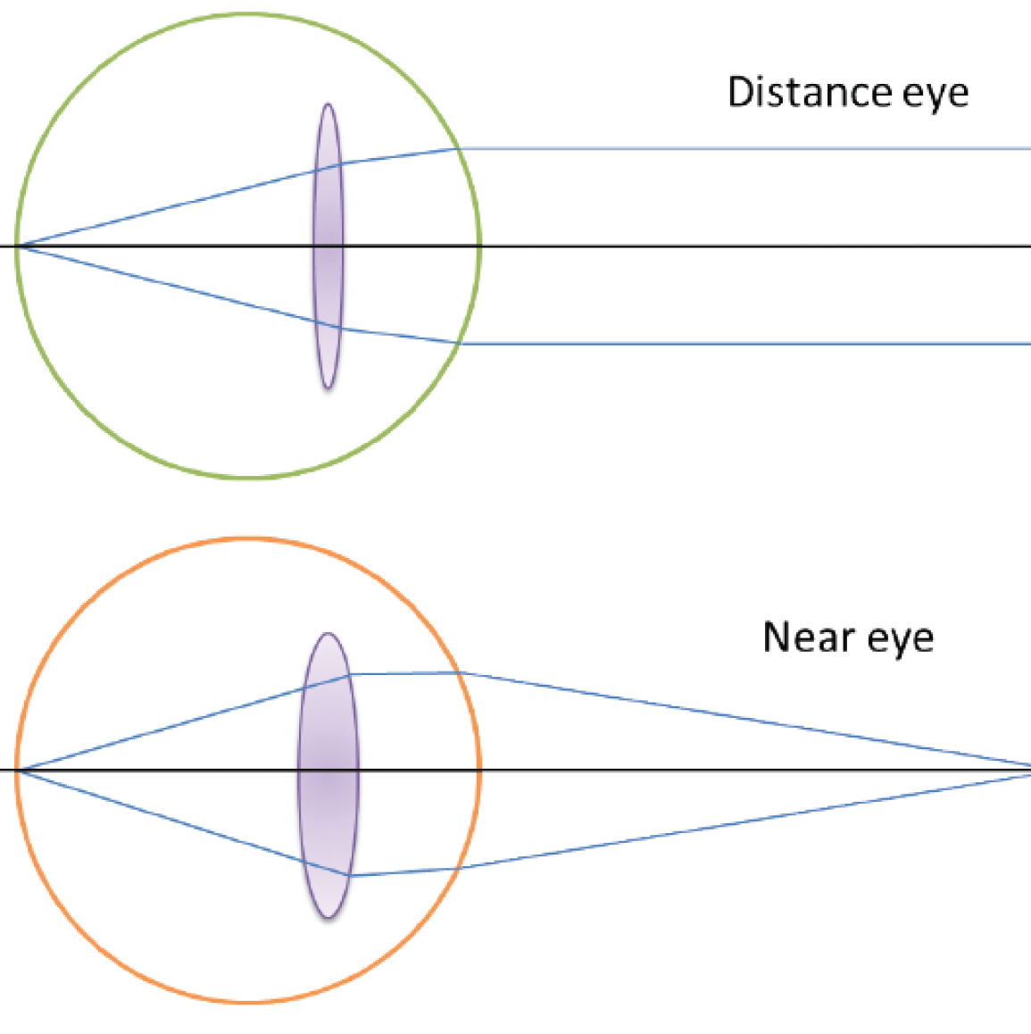 Monofocal lens diagram