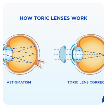 Toric lens diagram