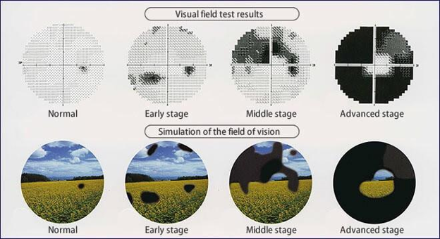 Vision types - near, intermediate and far vision illustration