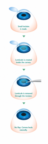 EDOF lens diagram