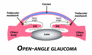 Femtosecond laser machine