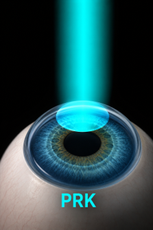 Doctor performing cataract examination