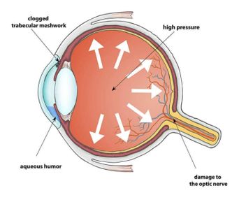 Doctor performing cataract examination