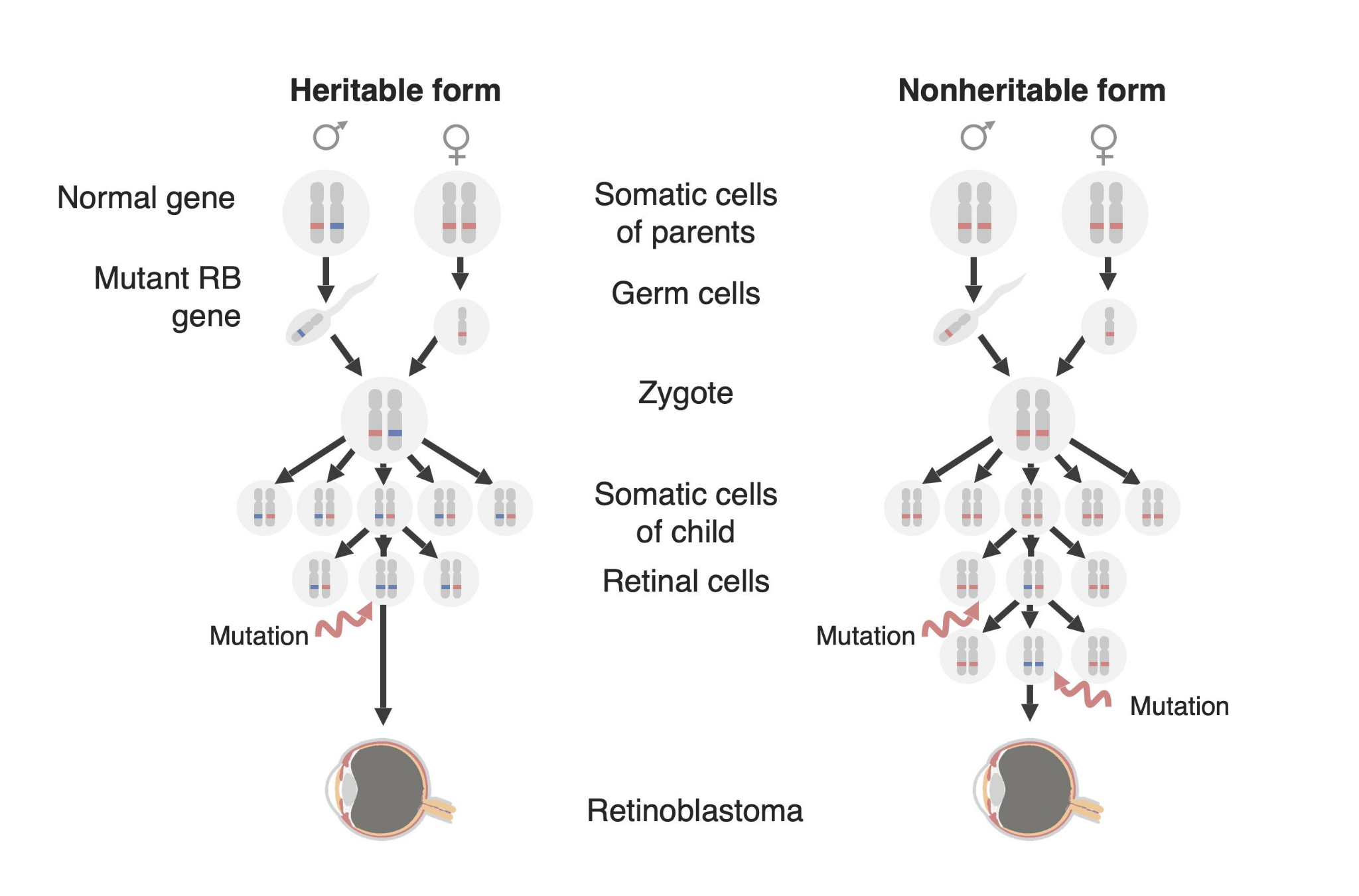Phacoemulsification procedure