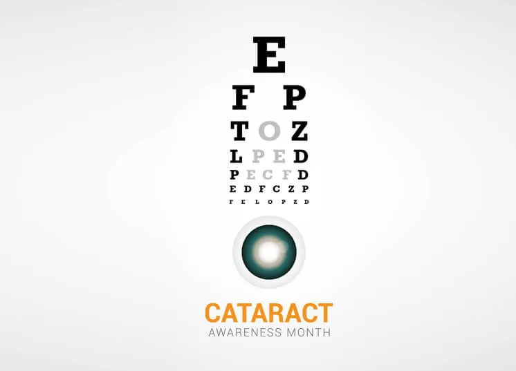 Robotic Cataract Surgery