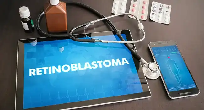 Retinoblastoma