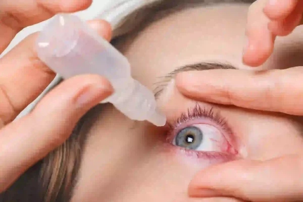 Dry Eye Syndrome