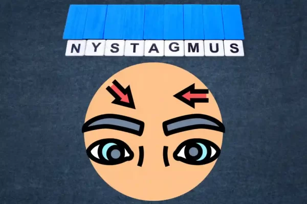 Nystagmus