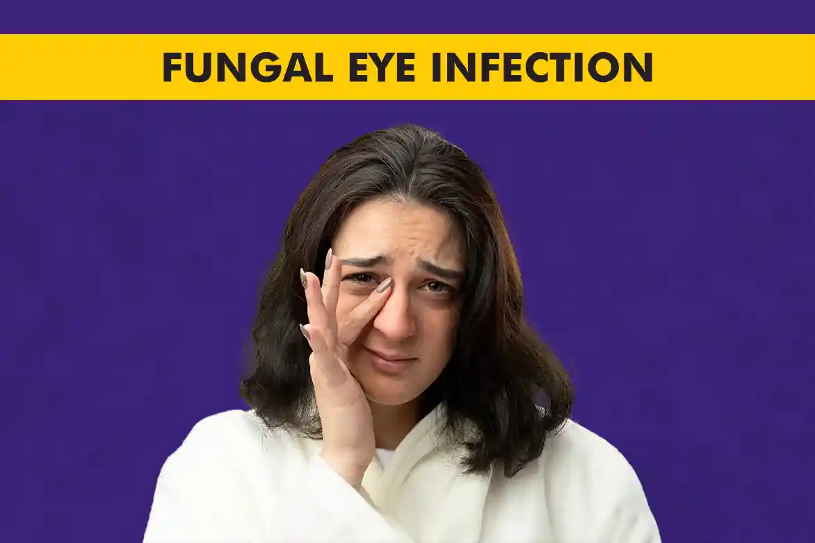 Fungal Eye Infections