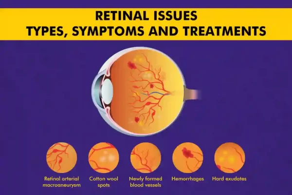 Retinal Diseases