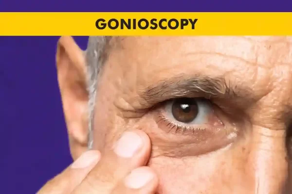 Gonioscopy procedure