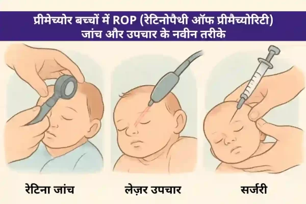 प्रिमैच्योर बच्चों में ROP (रेटिनोपैथी ऑफ प्रिमैच्योरिटी)