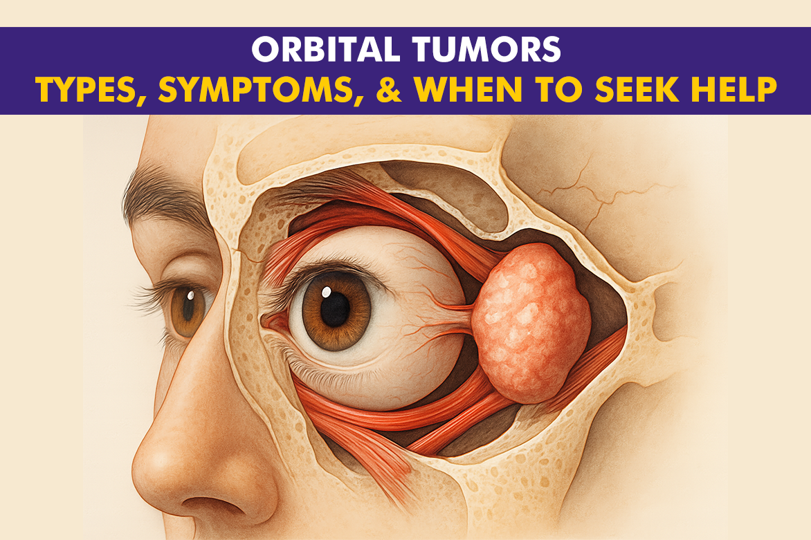 Orbital Tumors