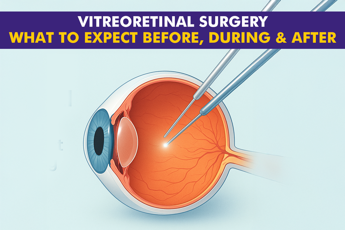 Vitreoretinal Surgery