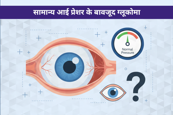 नॉर्मल टेंशन ग्लूकोमा