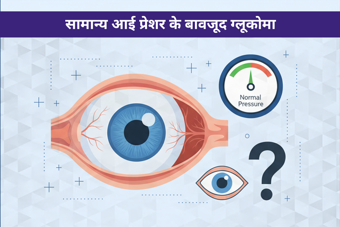 नॉर्मल टेंशन ग्लूकोमा